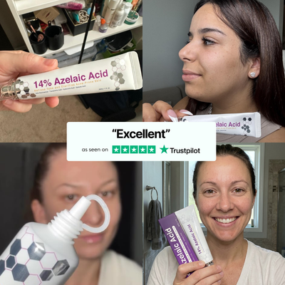 Azelaic Acid 14% Redness Reducing Cream