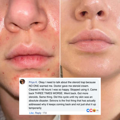 Azelaic Acid 14% POD Repair Cream