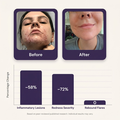 Azelaic Acid 14% POD Repair Cream